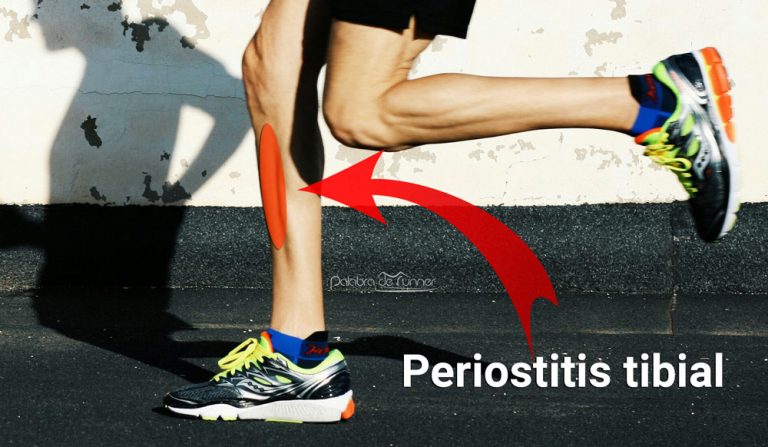 Periostitis Tibial Causas Tratamiento Y Ejercicios Para Aliviar El Dolor